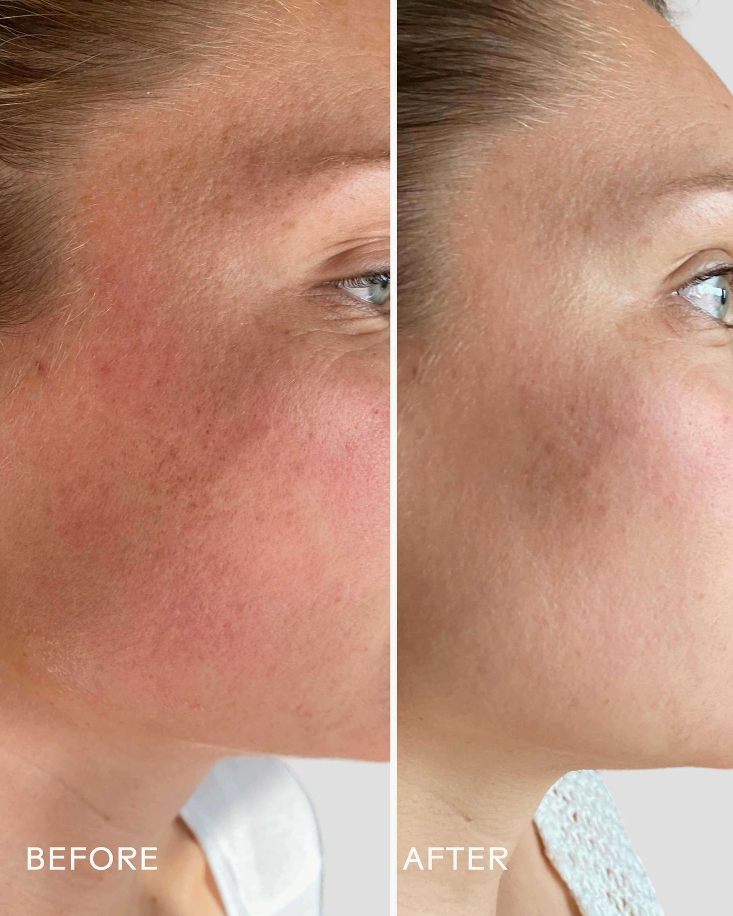 SkinHero™ Bakuchiol + Calendula Bio-Retinol Serum