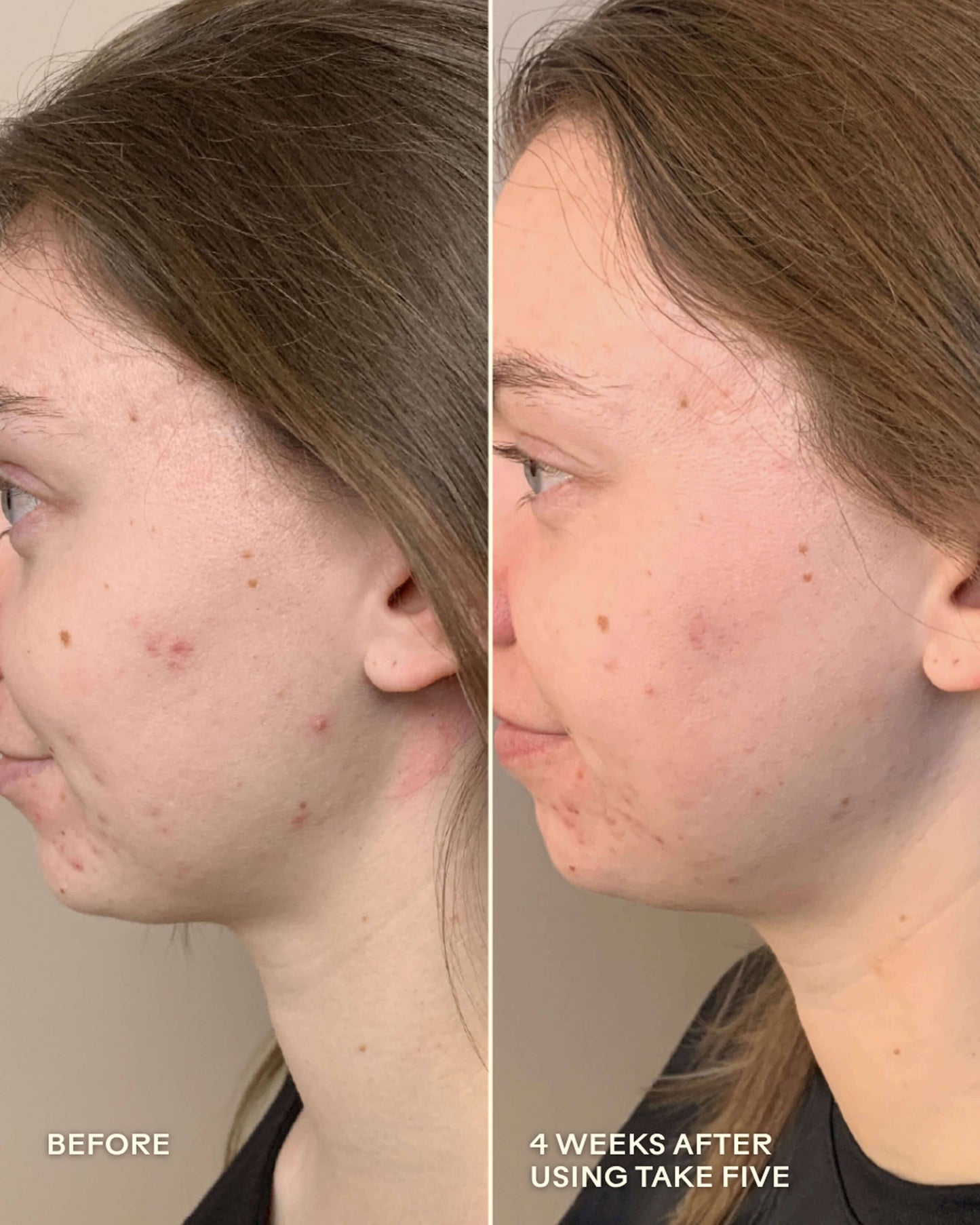 Take Five Hypochlorous Acid Balancing Body + Face Spray