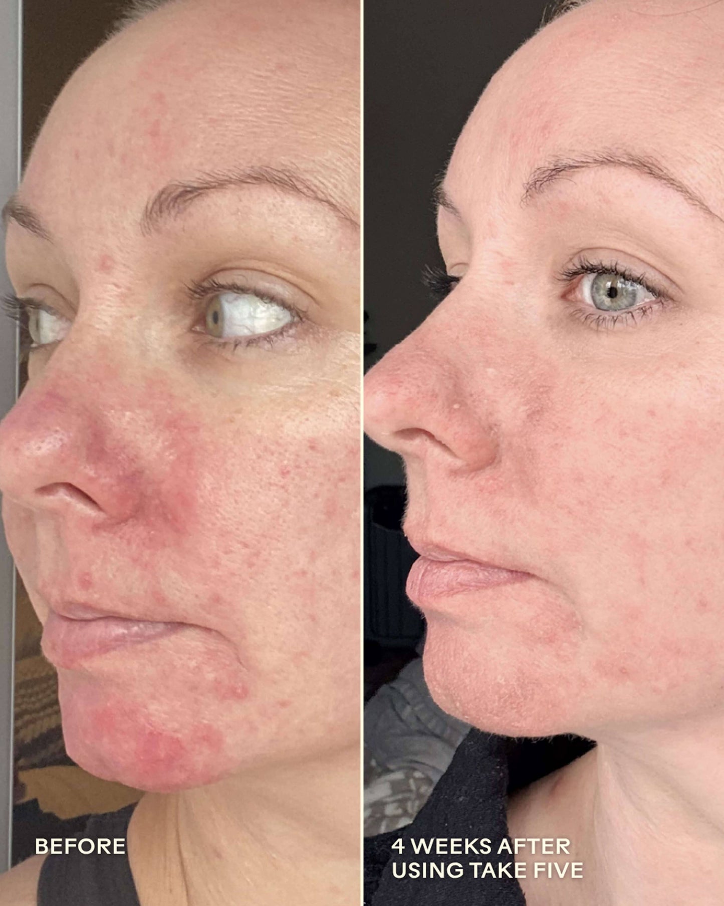 Take Five Hypochlorous Acid Balancing Body + Face Spray