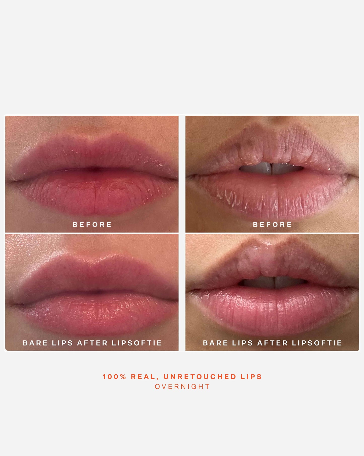 LipSoftie Hydrating Tinted Lip Treatment Balm