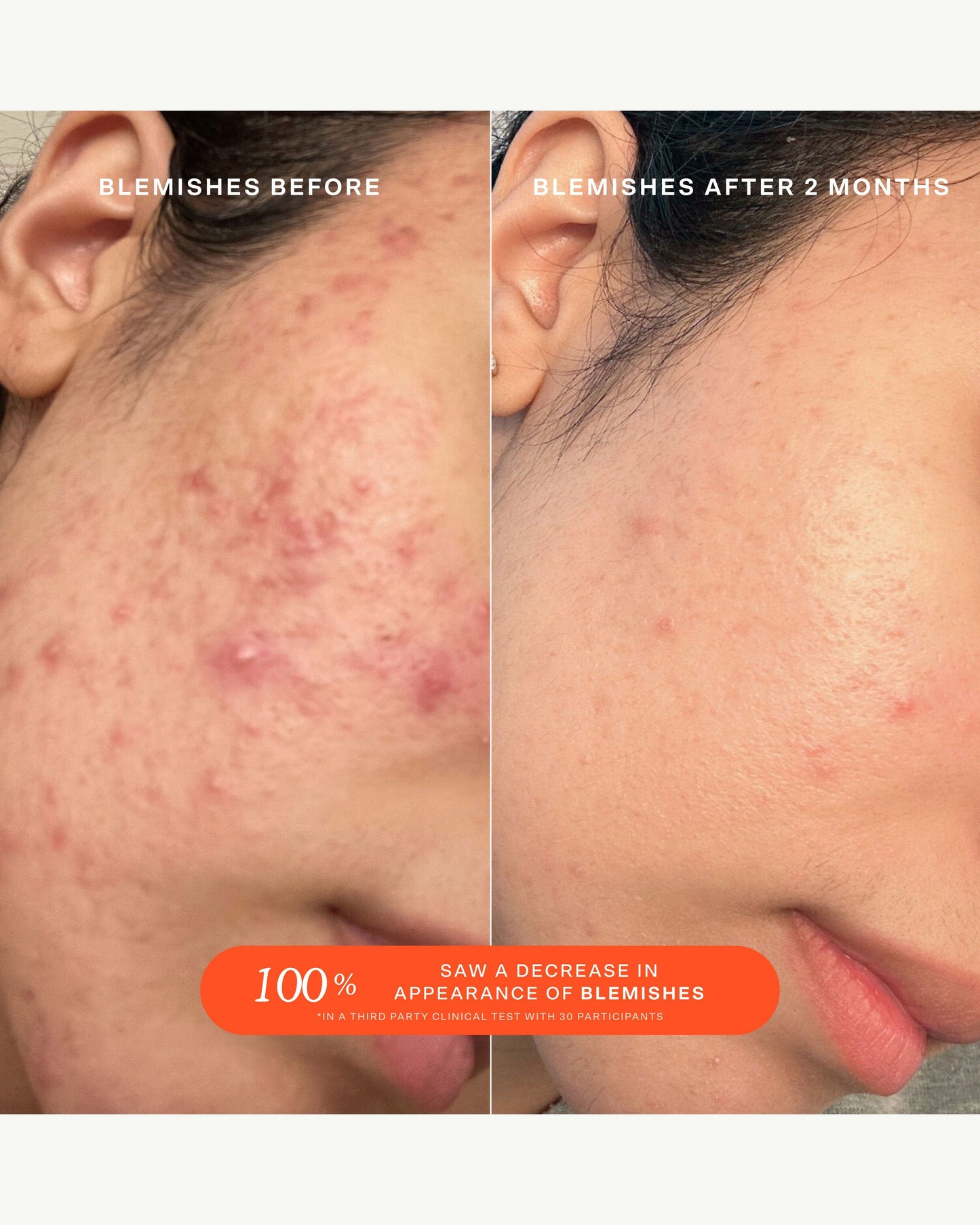 SOS (Save. Our. Skin) Daily Rescue Facial Spray with Hypochlorous Acid