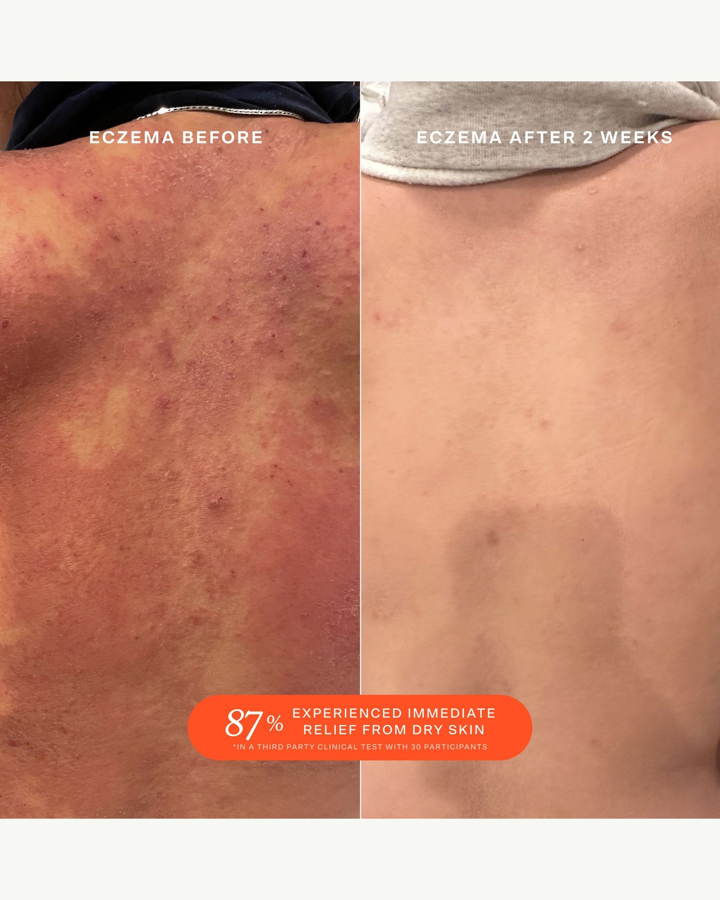 SOS (Save. Our. Skin) Daily Rescue Facial Spray with Hypochlorous Acid