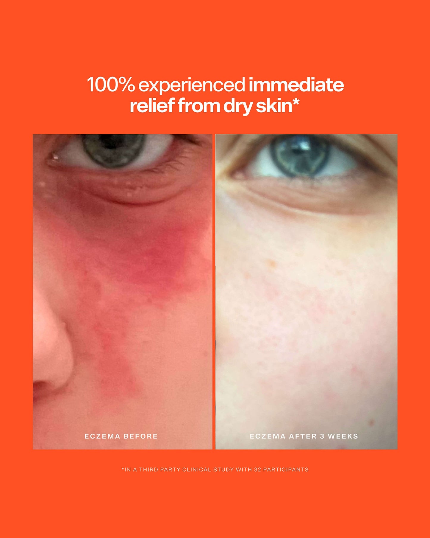 SOS Intensive Rescue Serum
