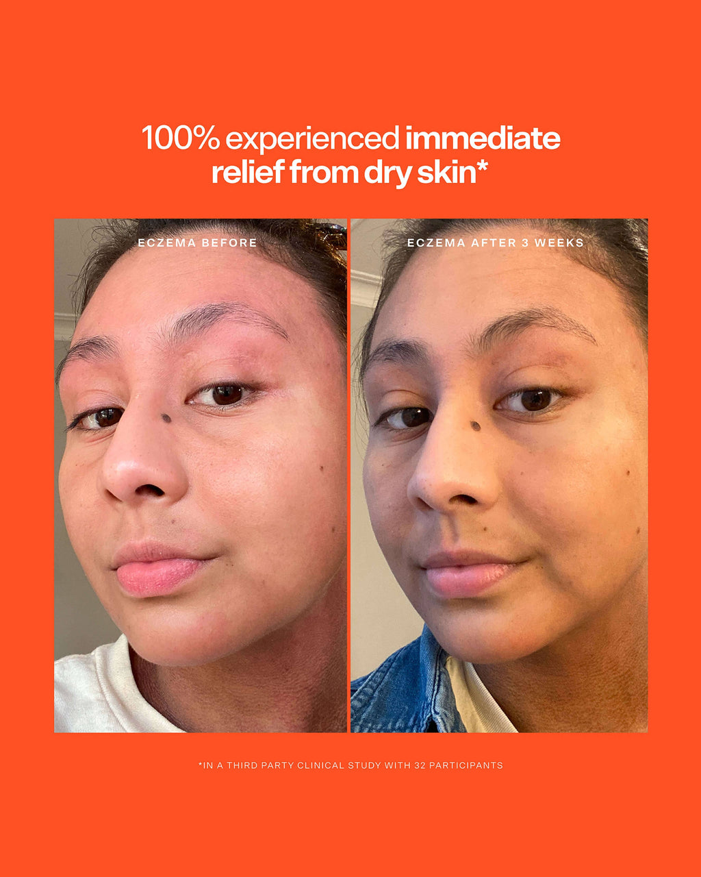 SOS Intensive Rescue Serum