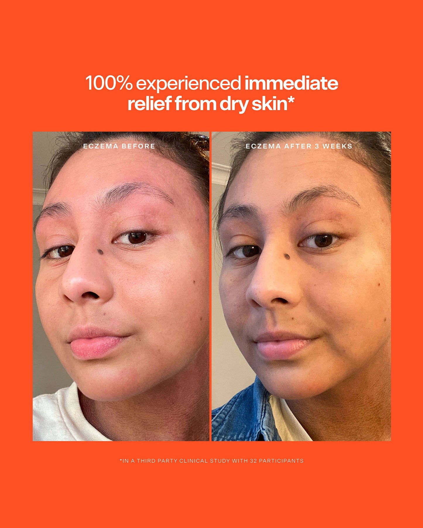 SOS Intensive Rescue Serum