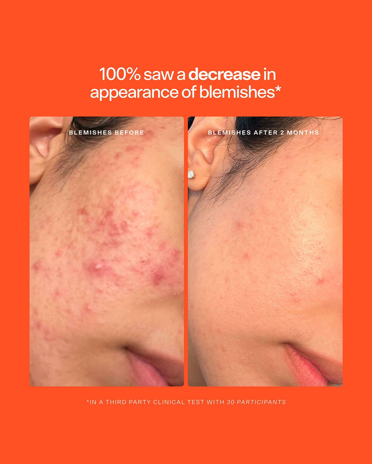 SOS Daily Rescue Spray Duo