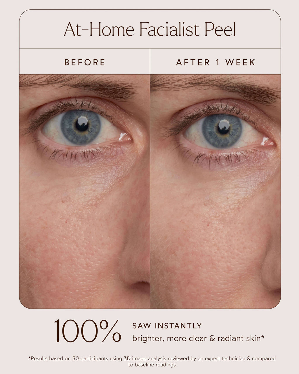 Peeling facial à domicile