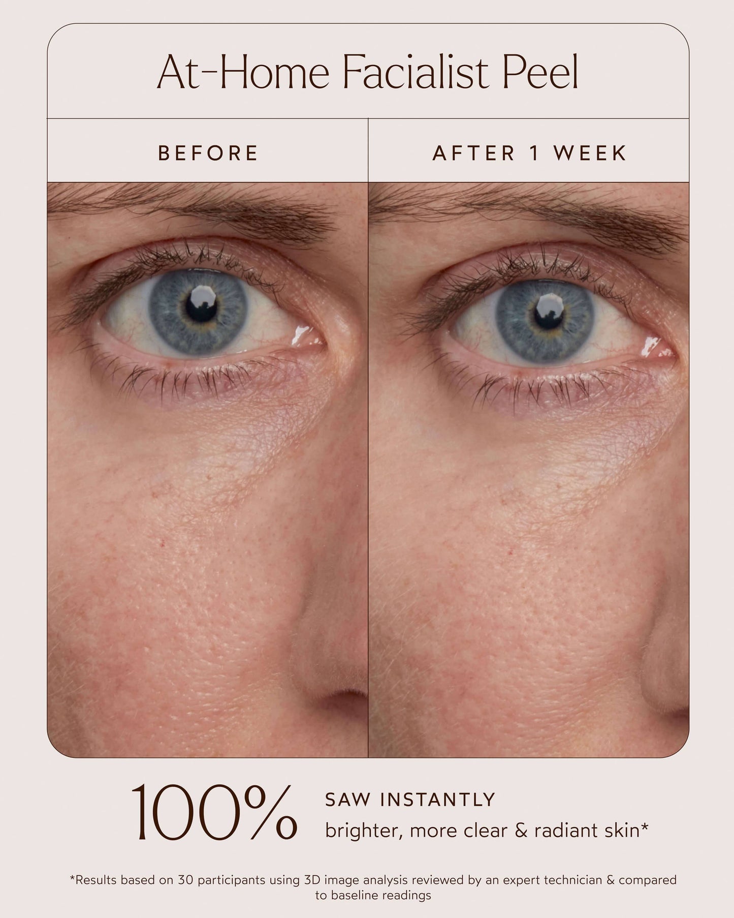 At-Home Facialist Peel
