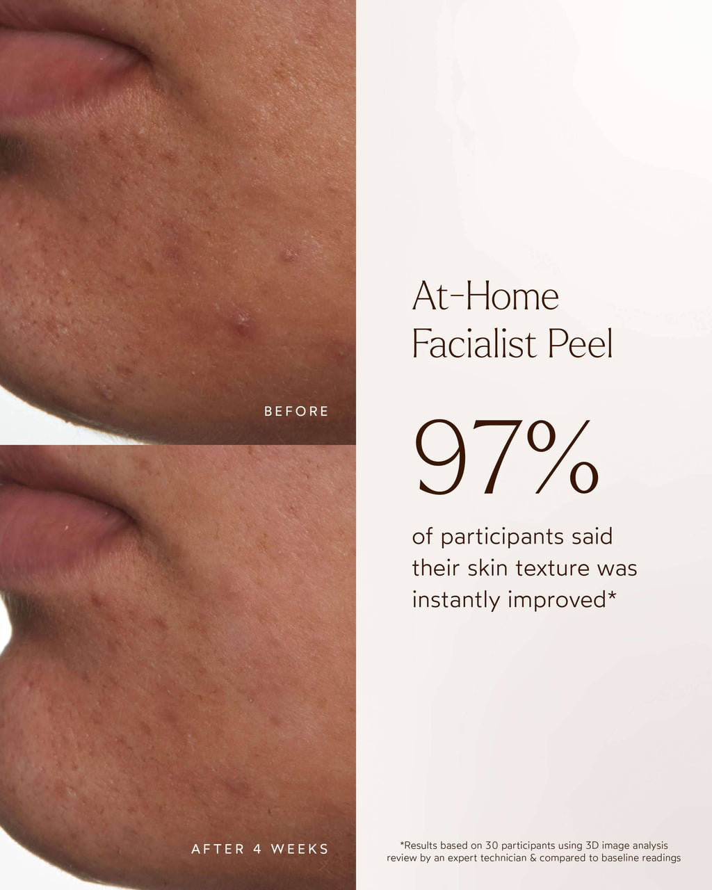 Peeling facial à domicile