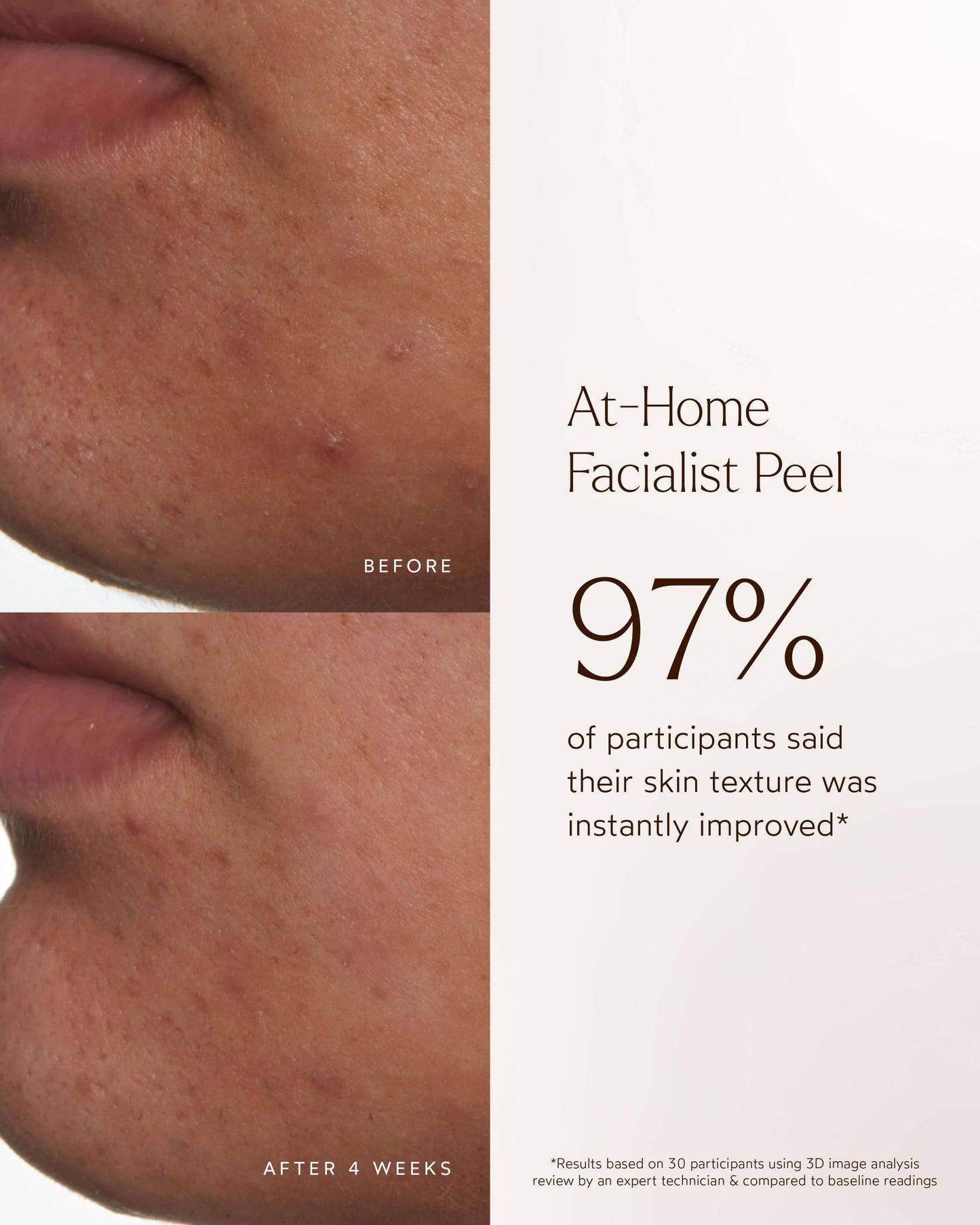 At-Home Facialist Peel
