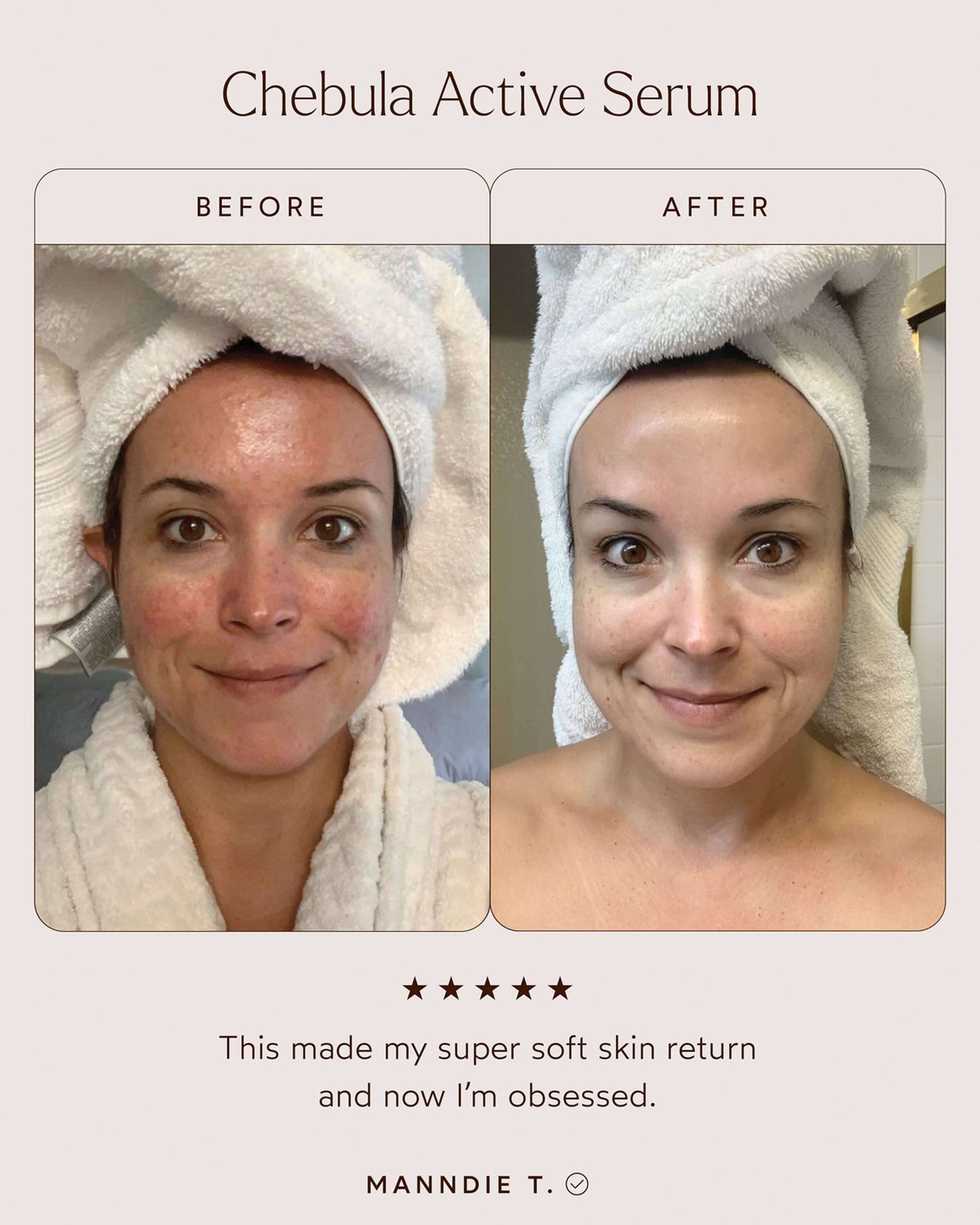 Chebula Active Anti-Aging Serum