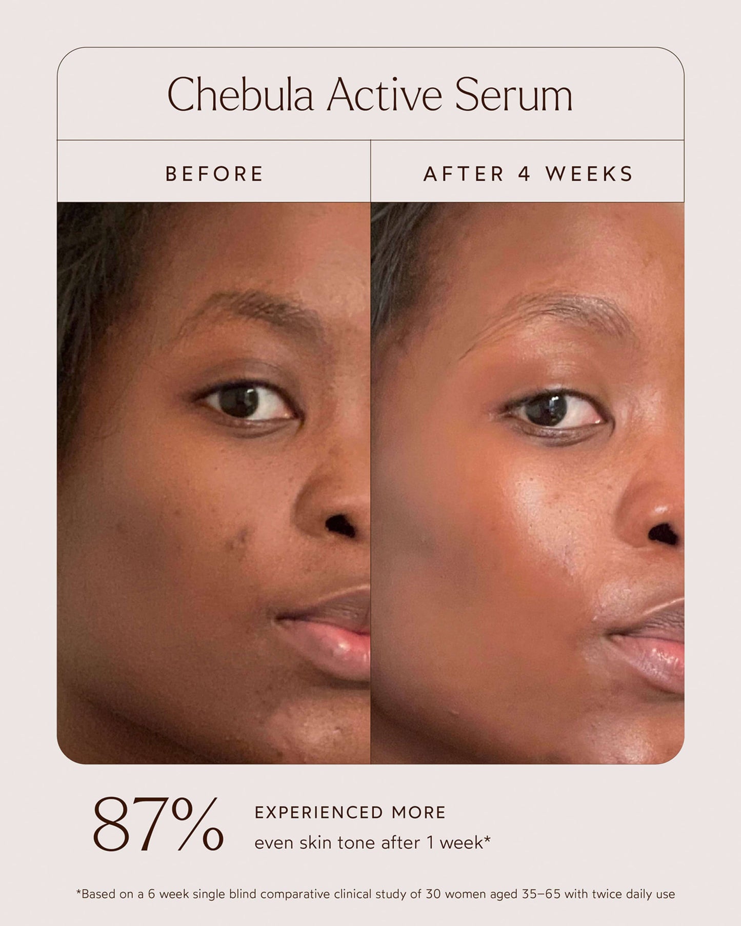 Chebula Active Anti-Aging Serum