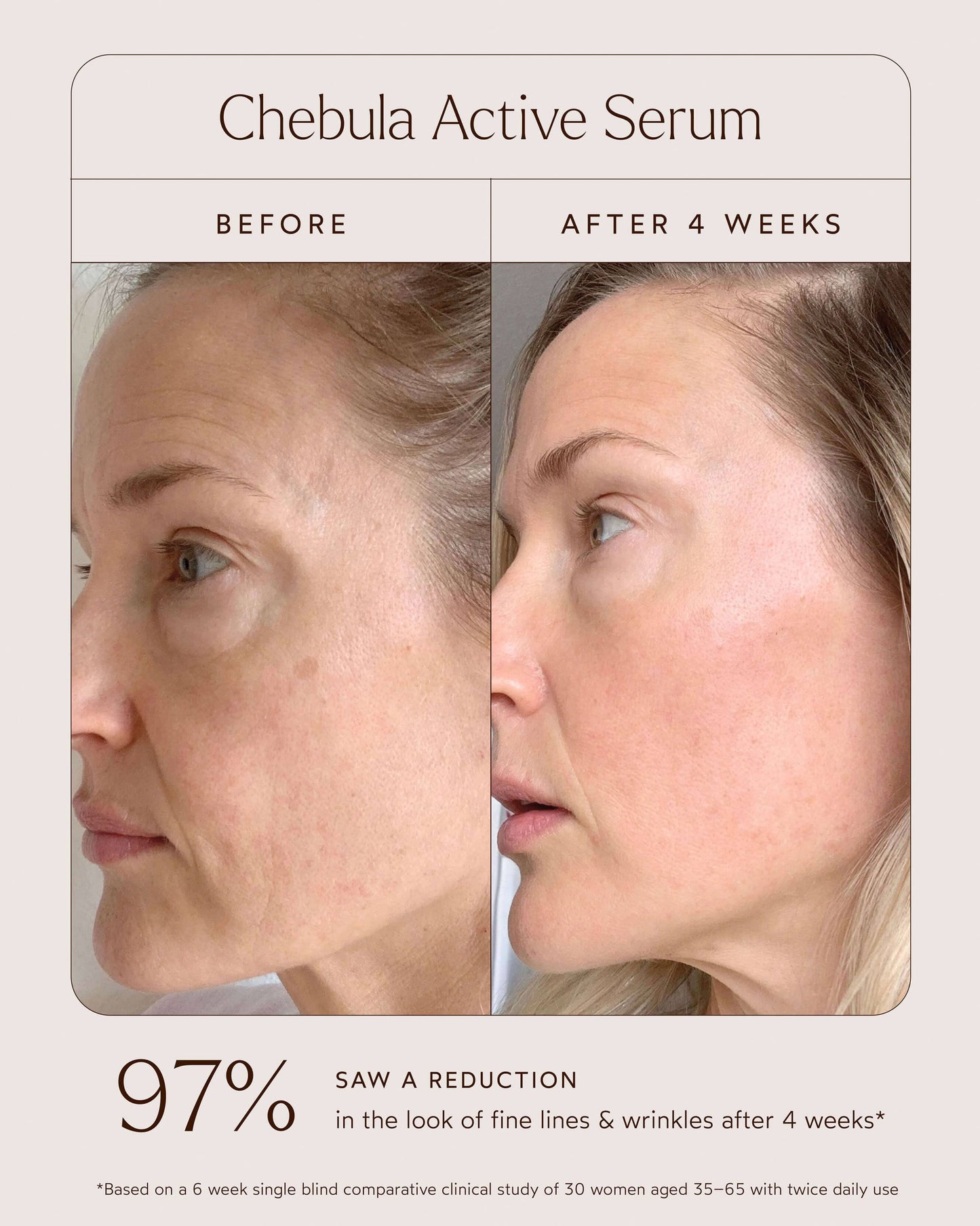 Chebula Active Anti-Aging Serum