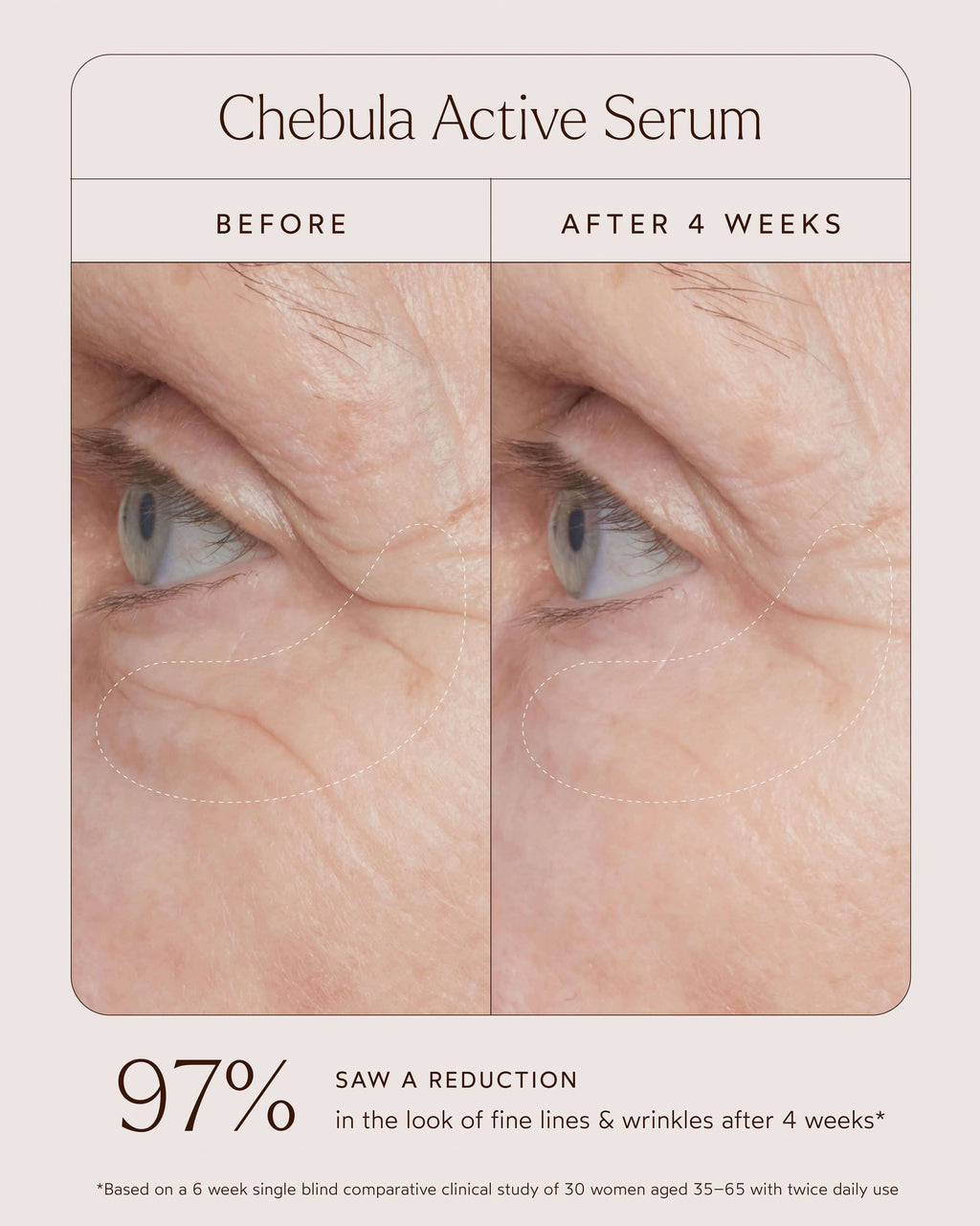Chebula Active Anti-Aging Serum