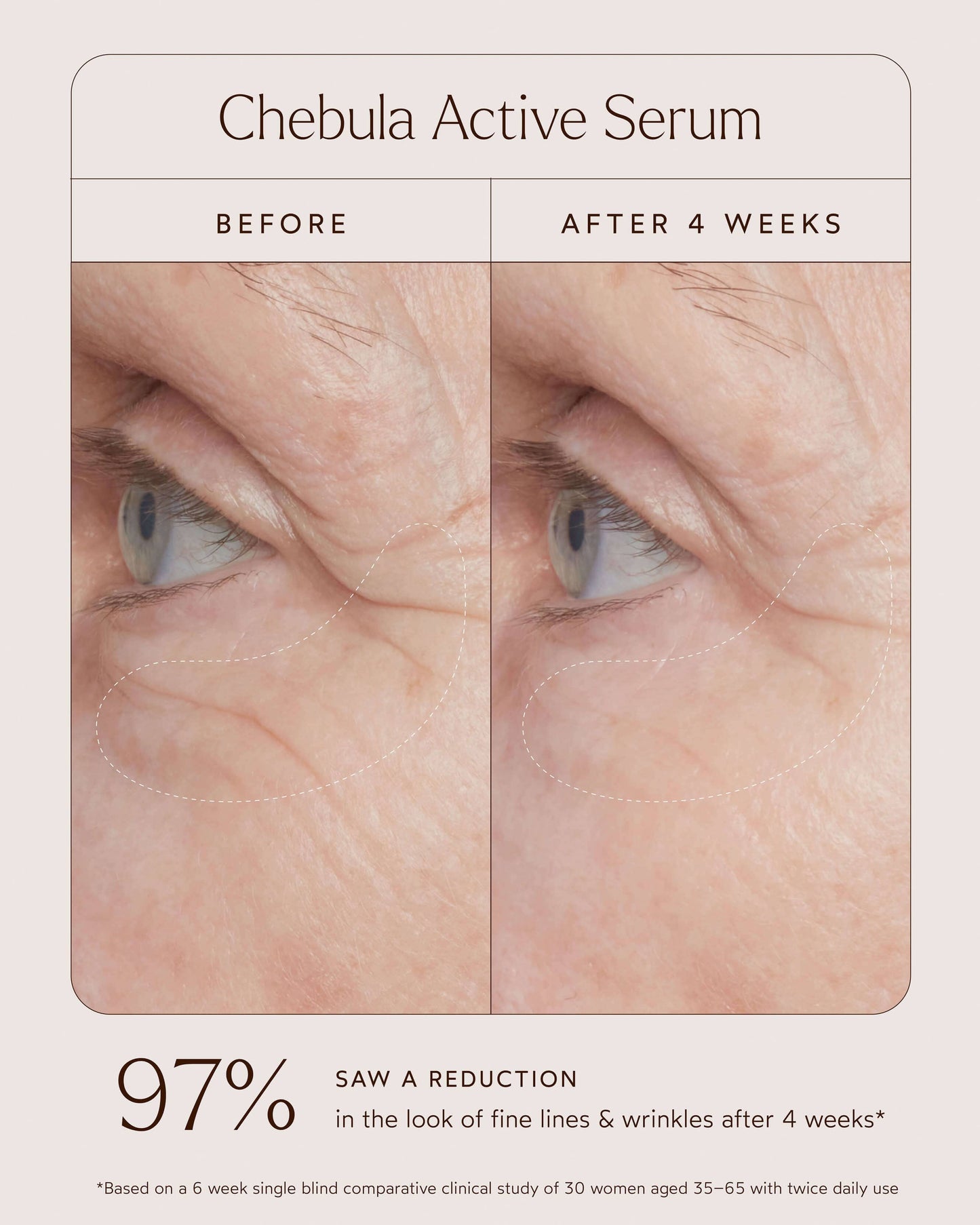 Chebula Active Anti-Aging Serum