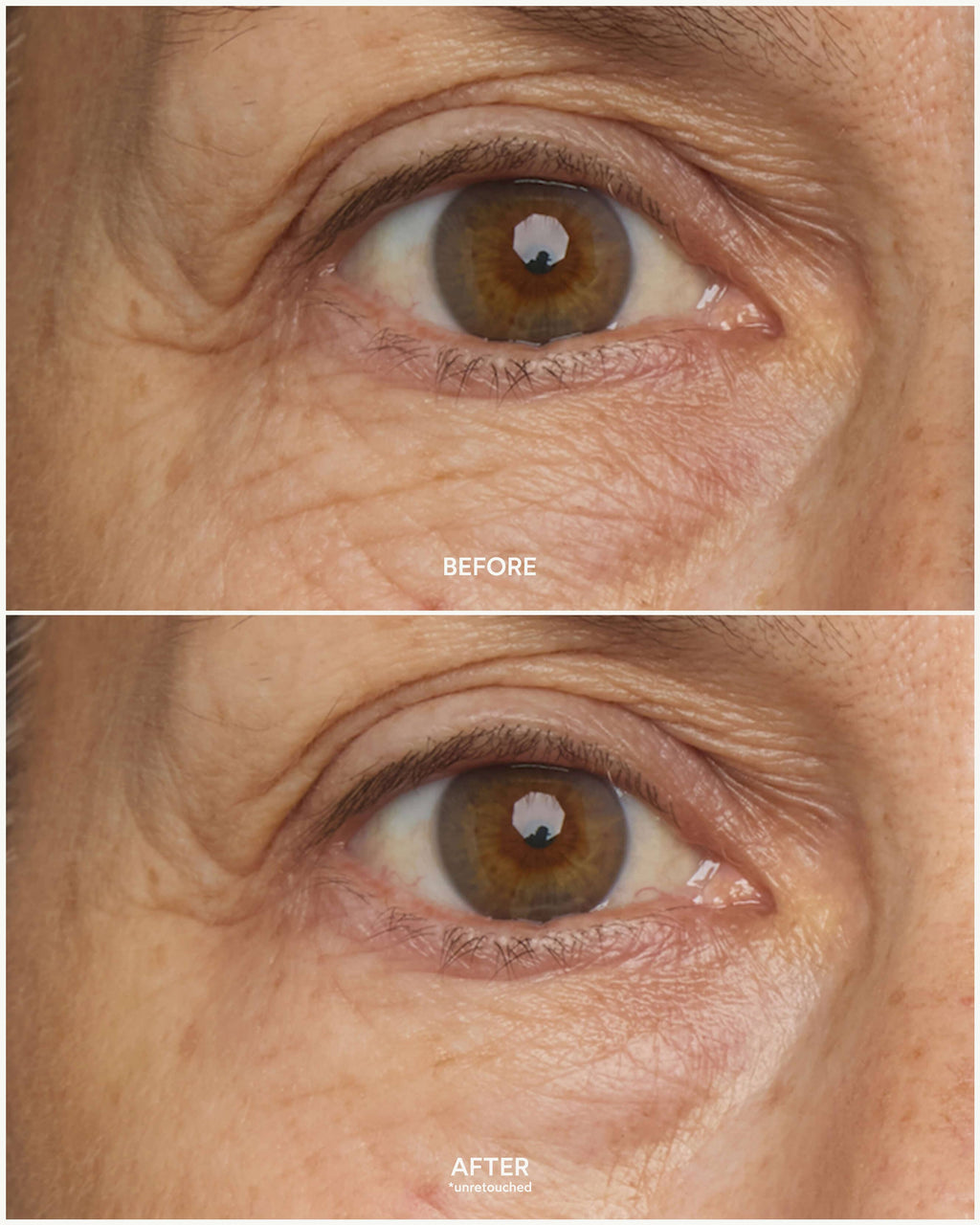 Patchs oculaires multi-correcteurs Chebula