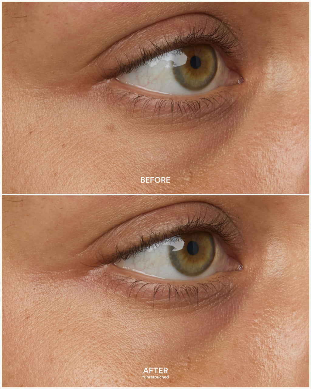 Patchs oculaires multi-correcteurs Chebula