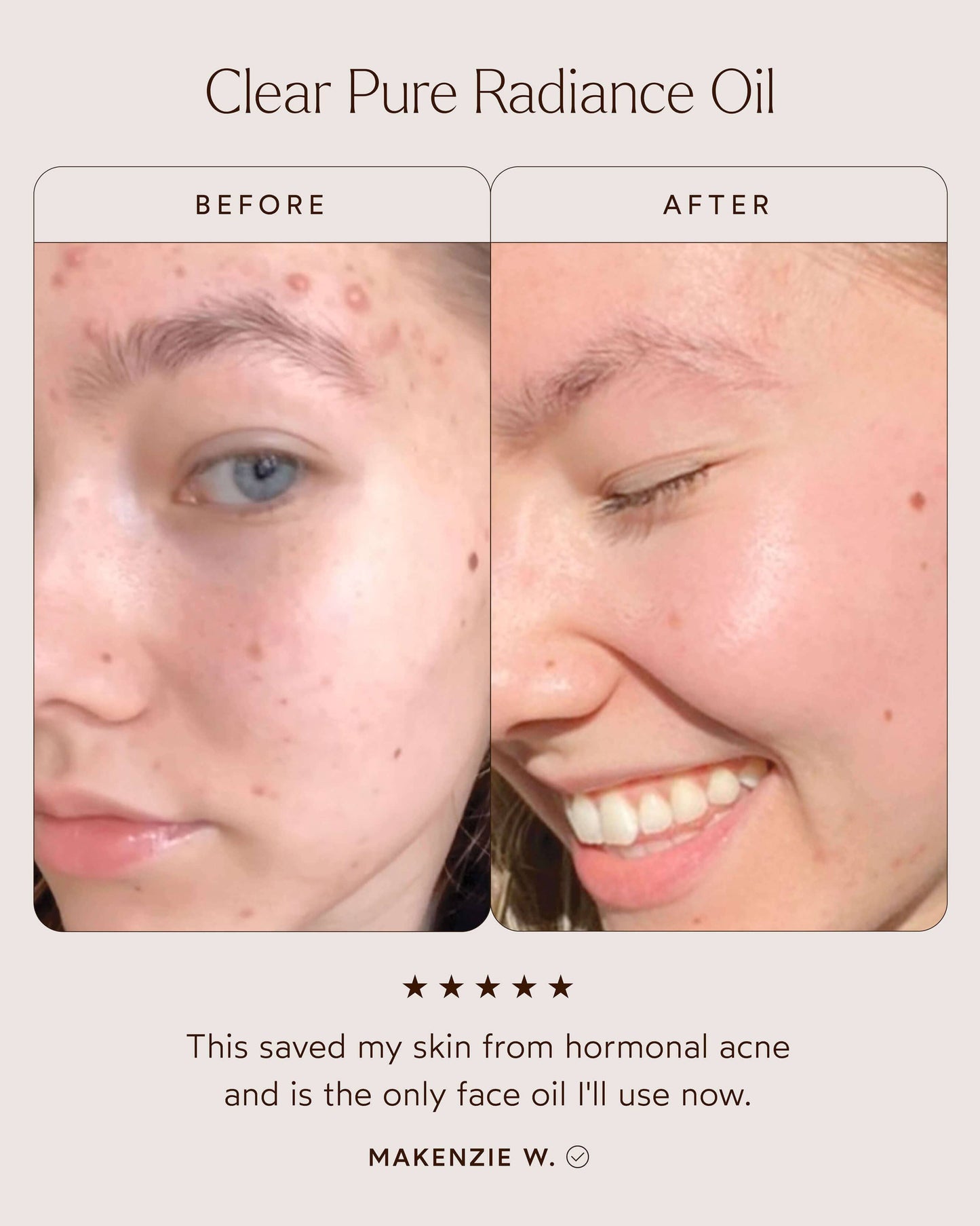 Clear Pure Radiance Oil