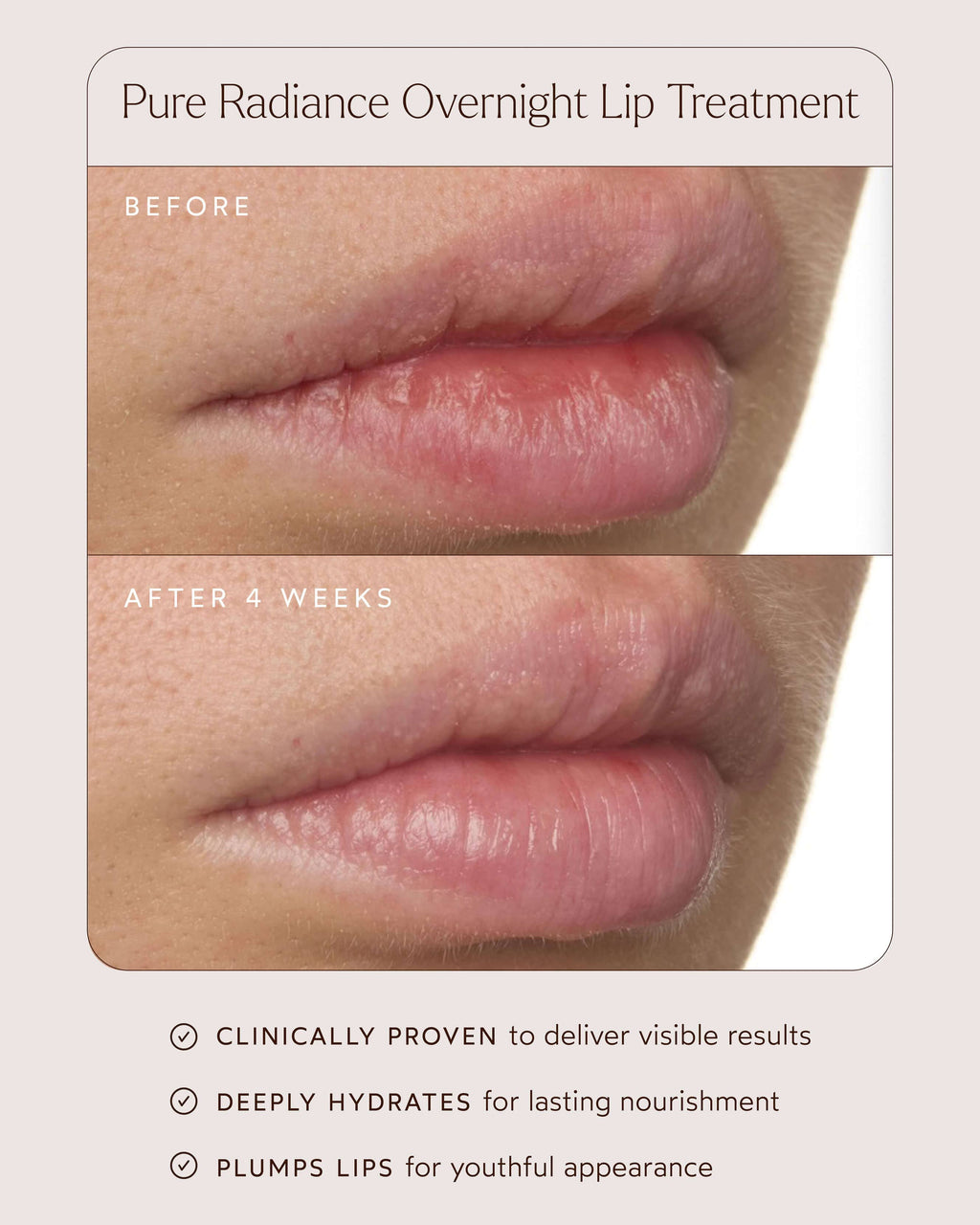 Soin de nuit pour les lèvres Pure Radiance
