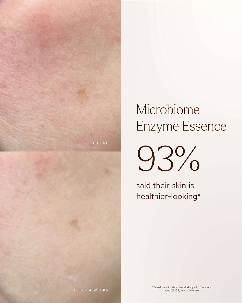Essence Enzymatique Renouvelante Microbiome