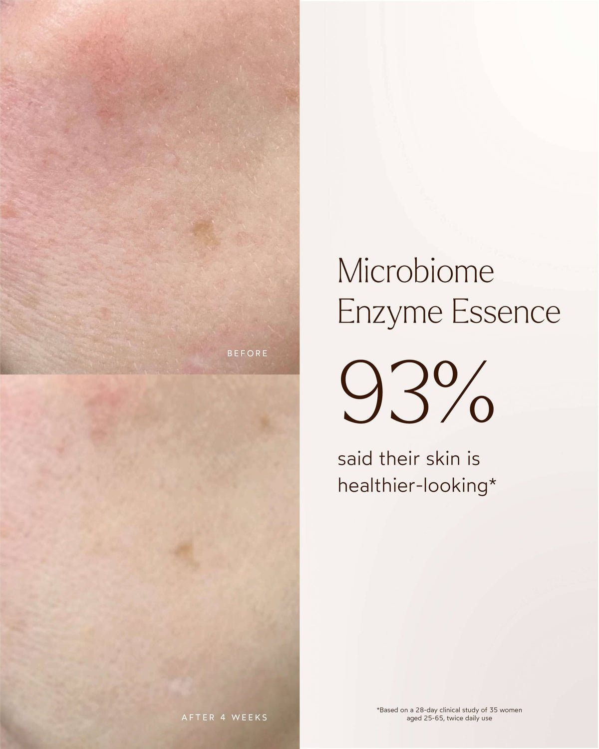 Renew Microbiome Enzyme Essence