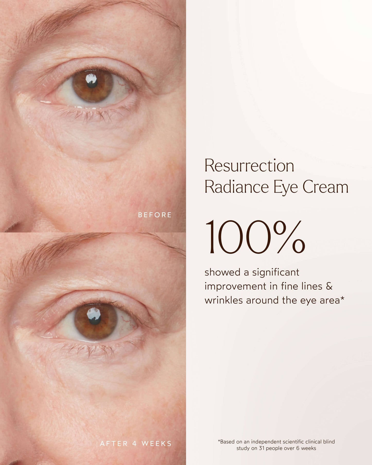 Resurrection Radiance Anti-Aging Eye Cream