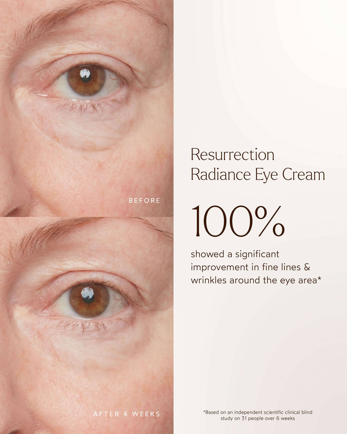Crème Contour des Yeux Anti-Âge Éclat Renaissance