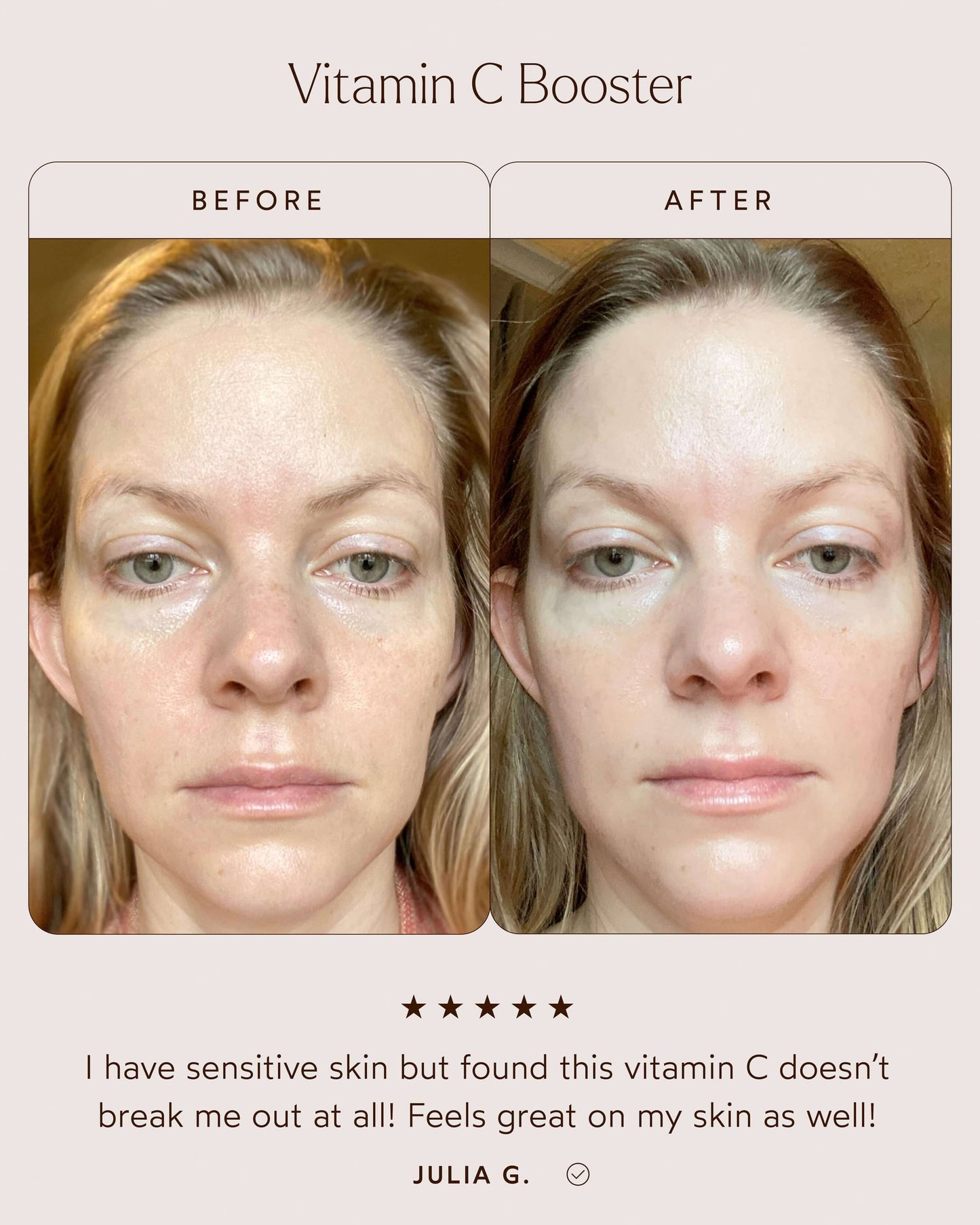 Vitamin C Booster