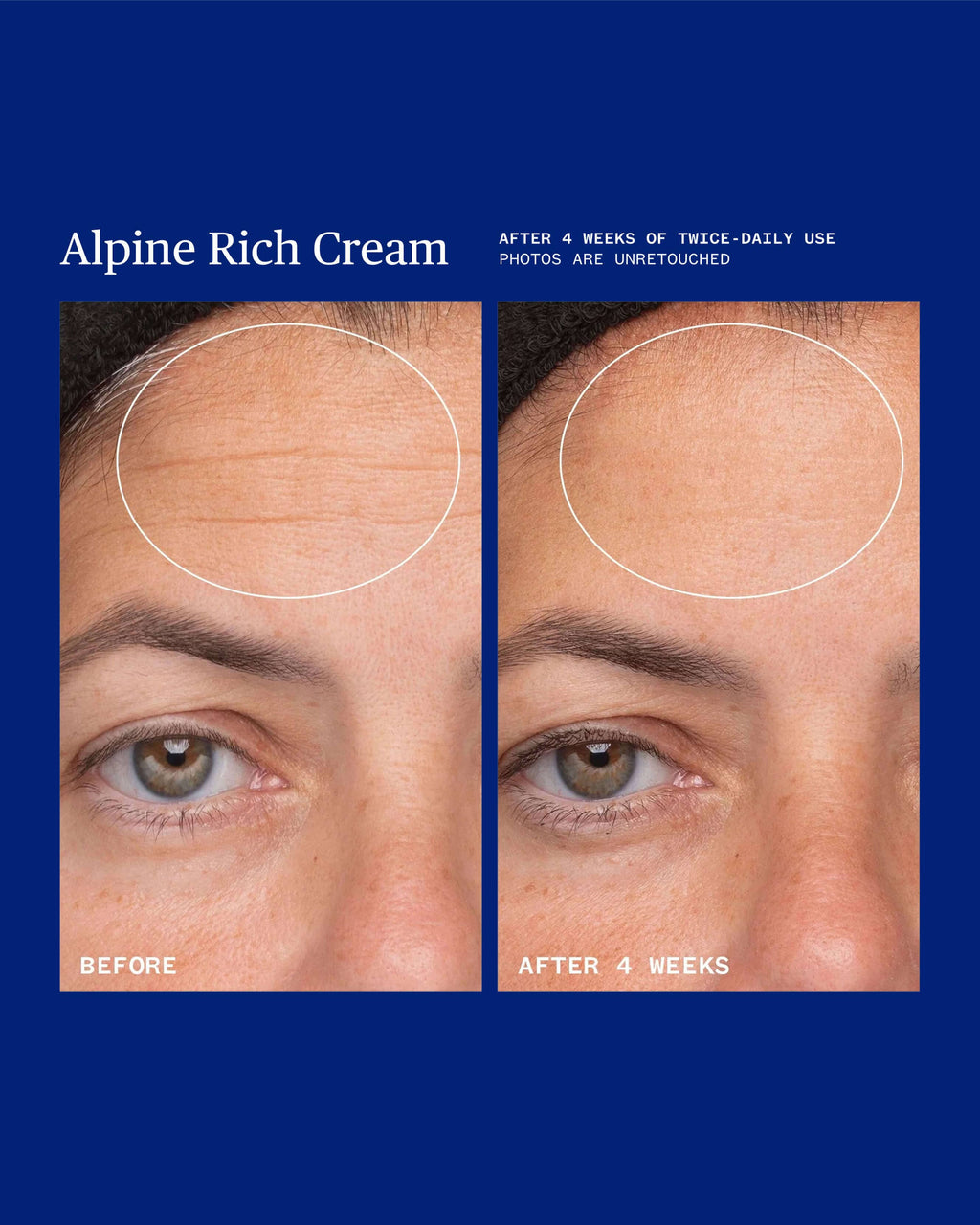 Alpine Rich Cream Barrier Moisturizer for Dry & Sensitive Skin