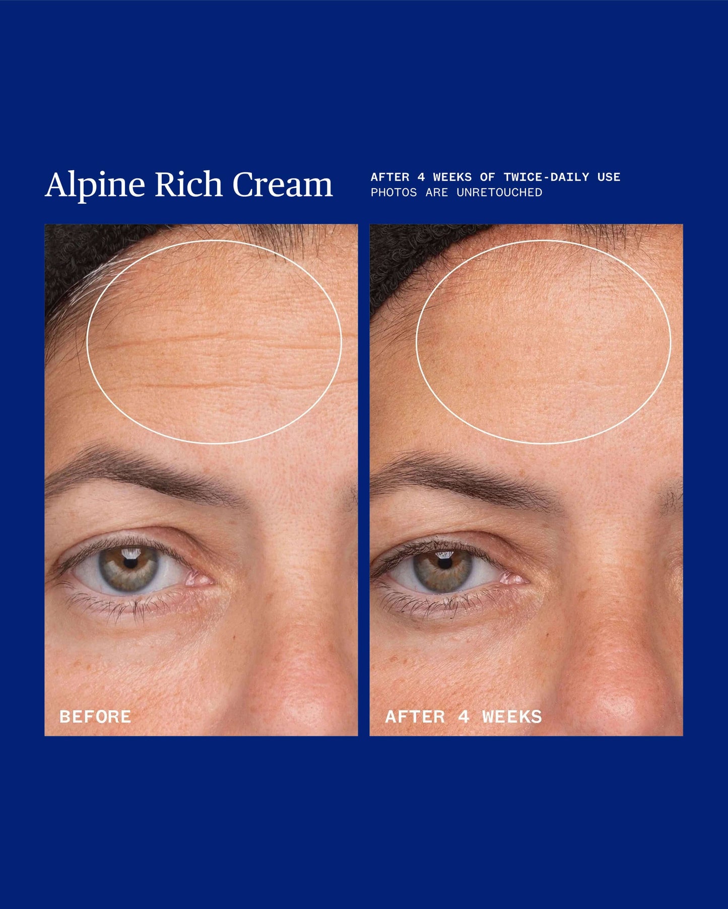 Alpine Rich Cream Barrier Moisturizer for Dry & Sensitive Skin
