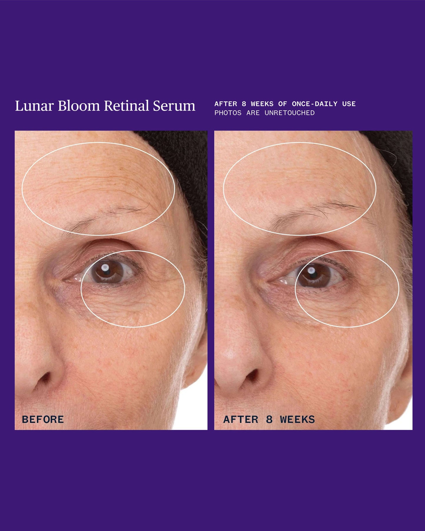 Lunar Bloom Retinol Serum for Fine Lines, Wrinkles & Uneven Skin Tone