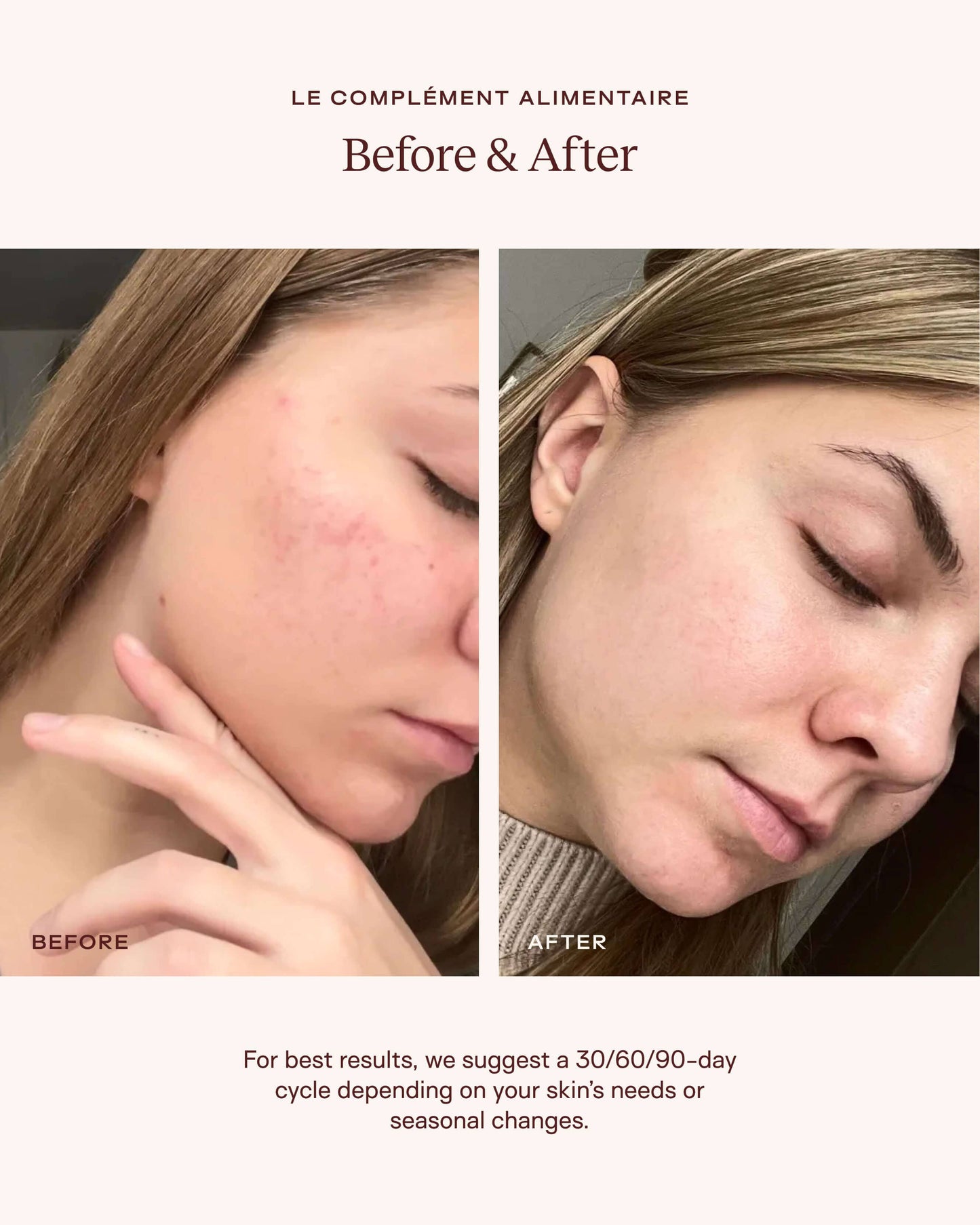 Le Complément Alimentaire – Ceramide-Rich Skin Supplement