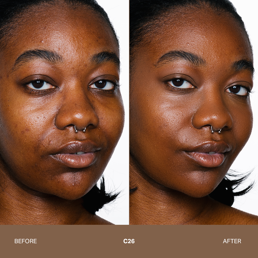 Magic Star™ Concealer