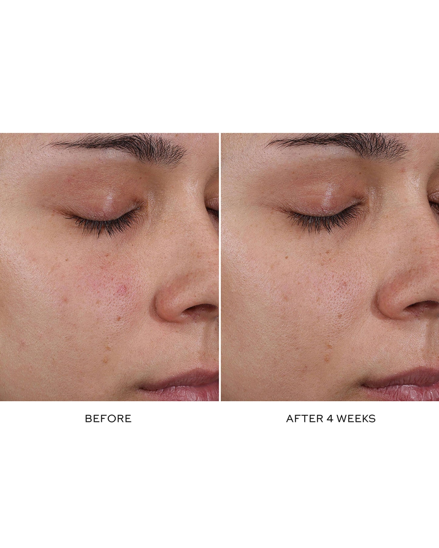 Pore Refining Complex