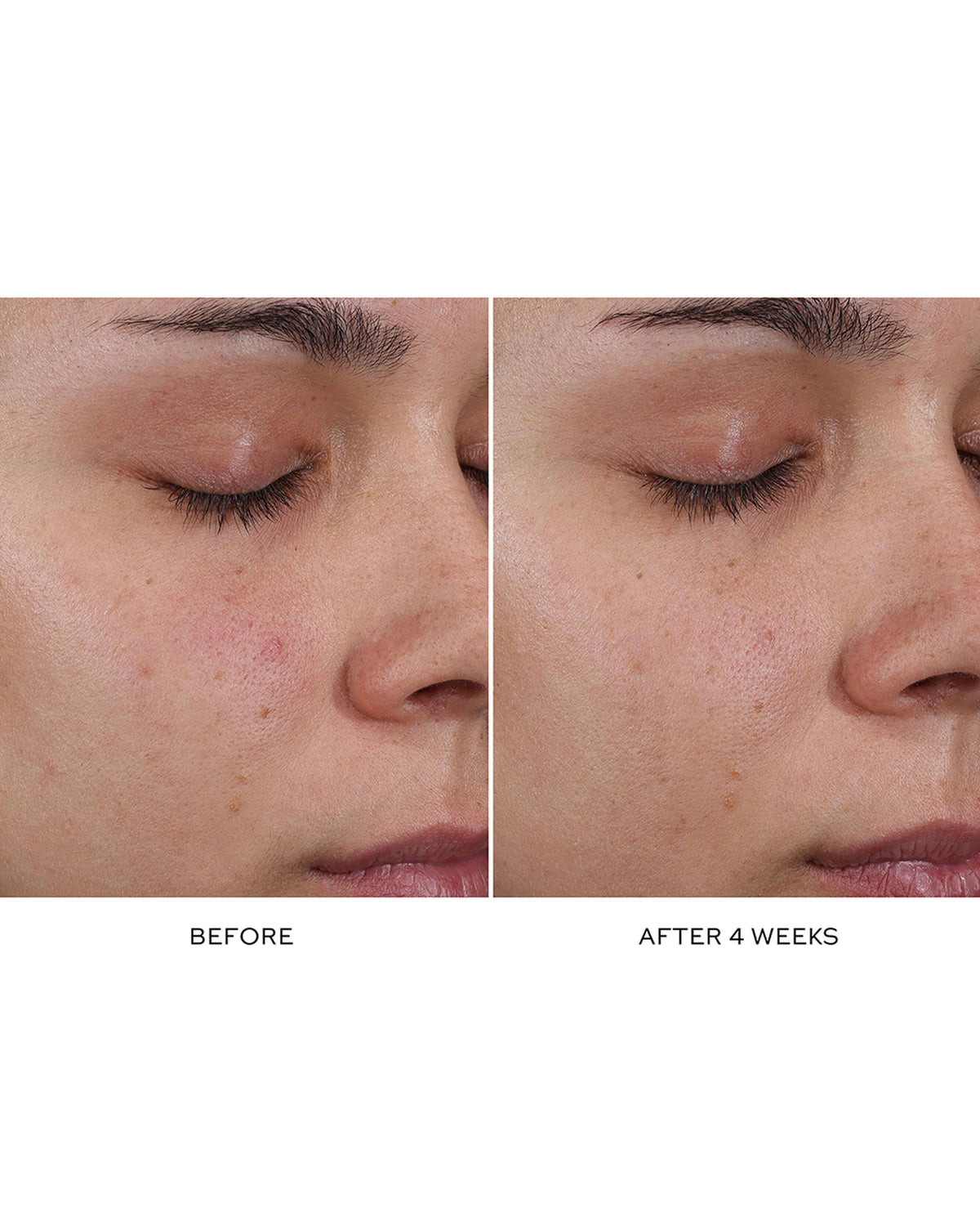 Pore Refining Complex