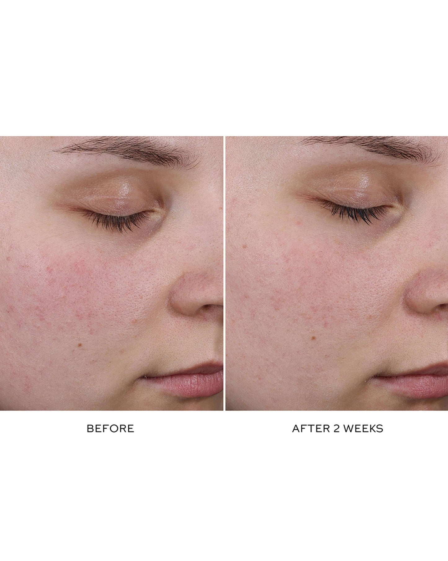 Pore Refining Complex