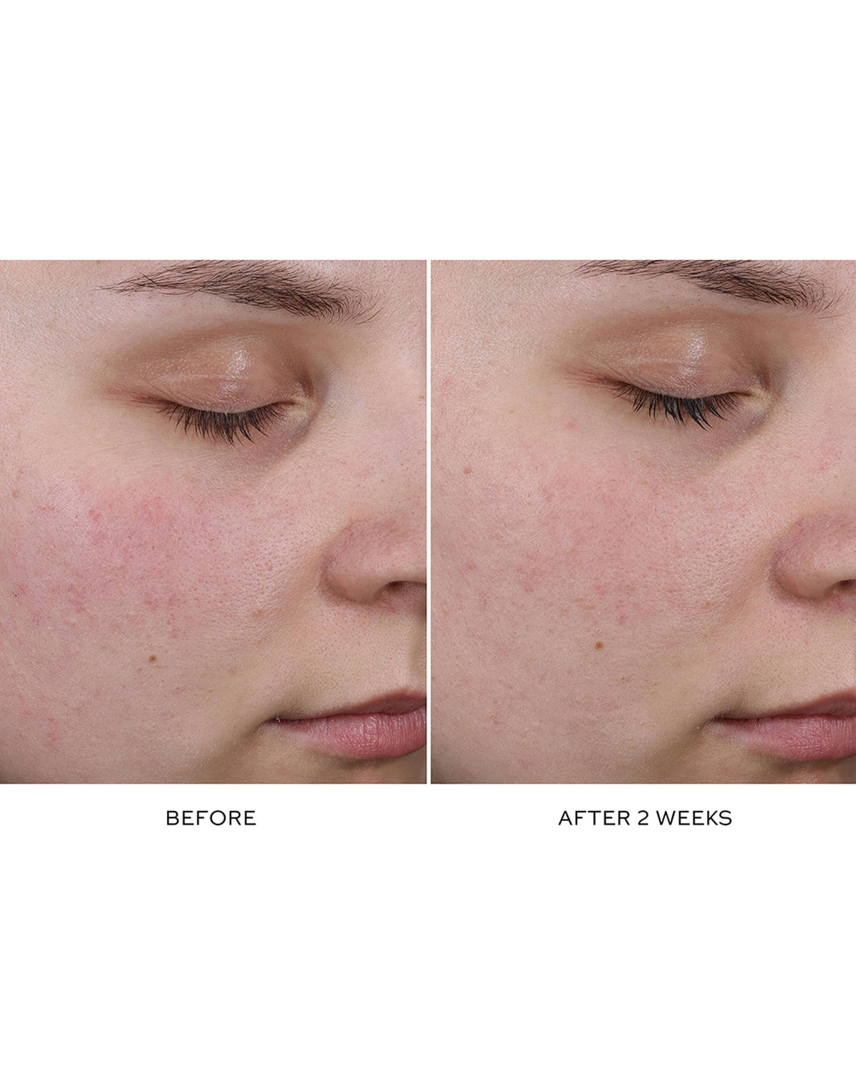 Pore Refining Complex