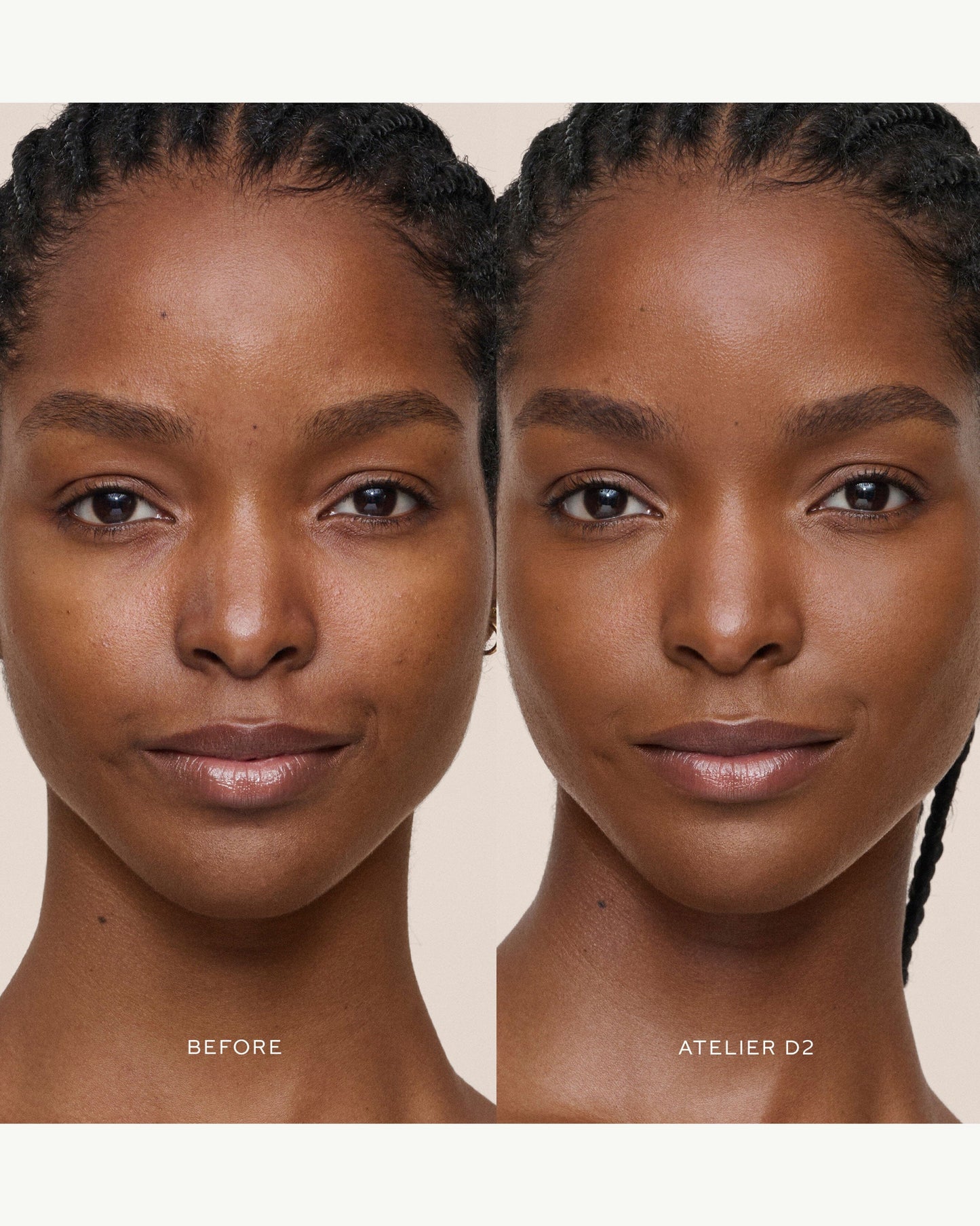 Vital Skincare Concealer