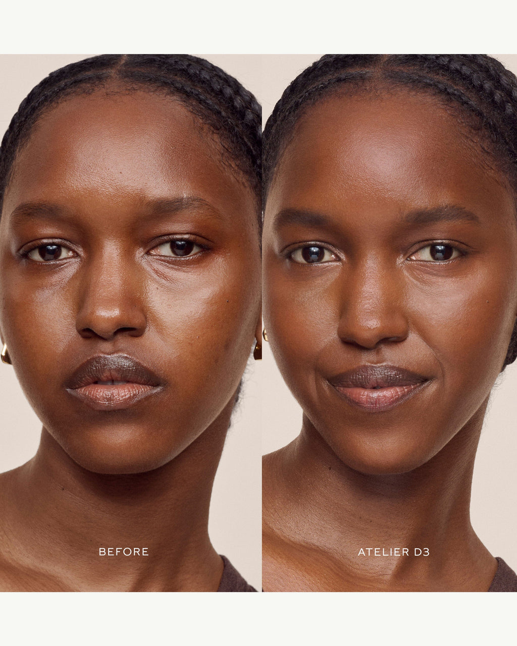 Vital Skincare Concealer