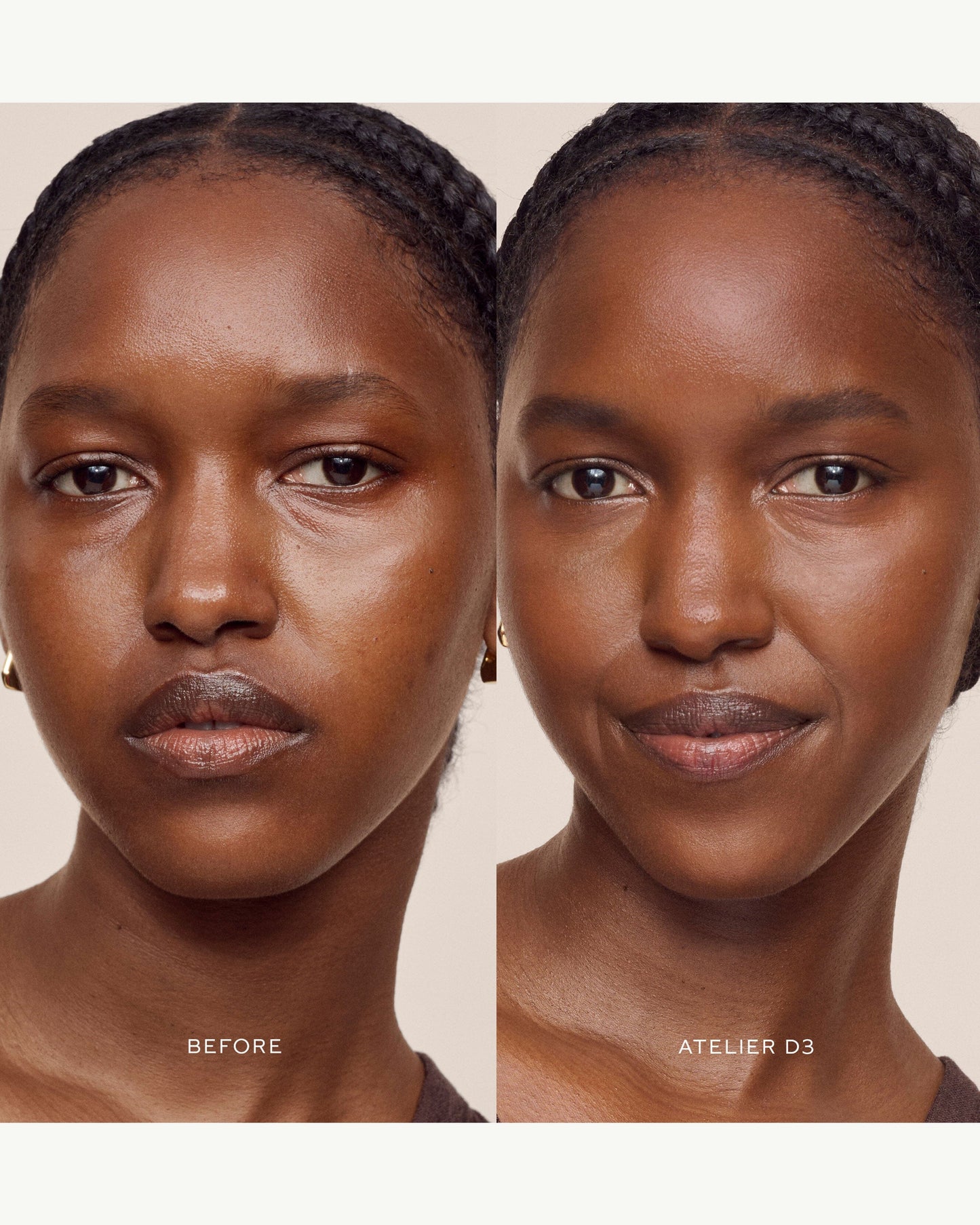 Vital Skincare Concealer