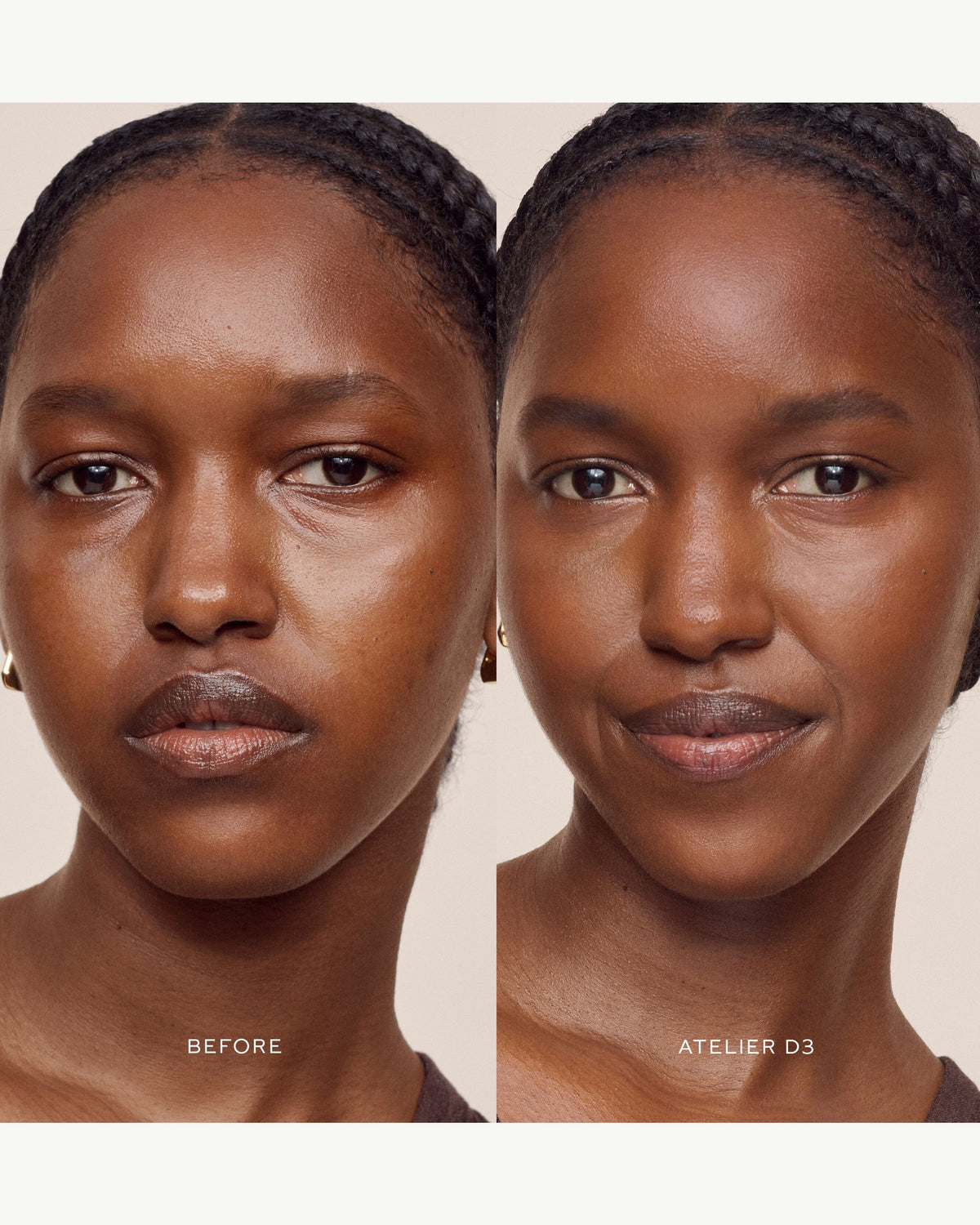 Vital Skincare Concealer