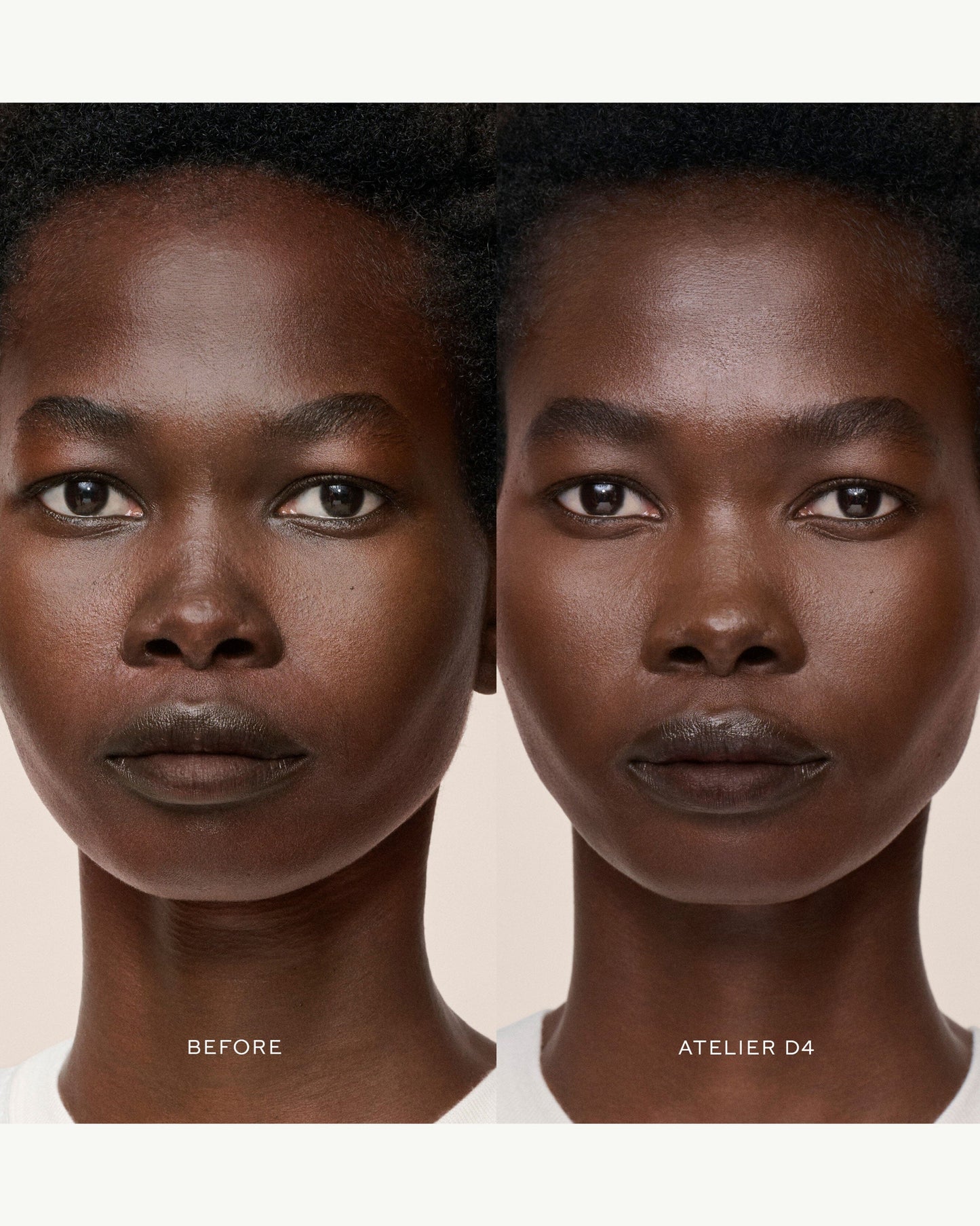 Vital Skincare Concealer