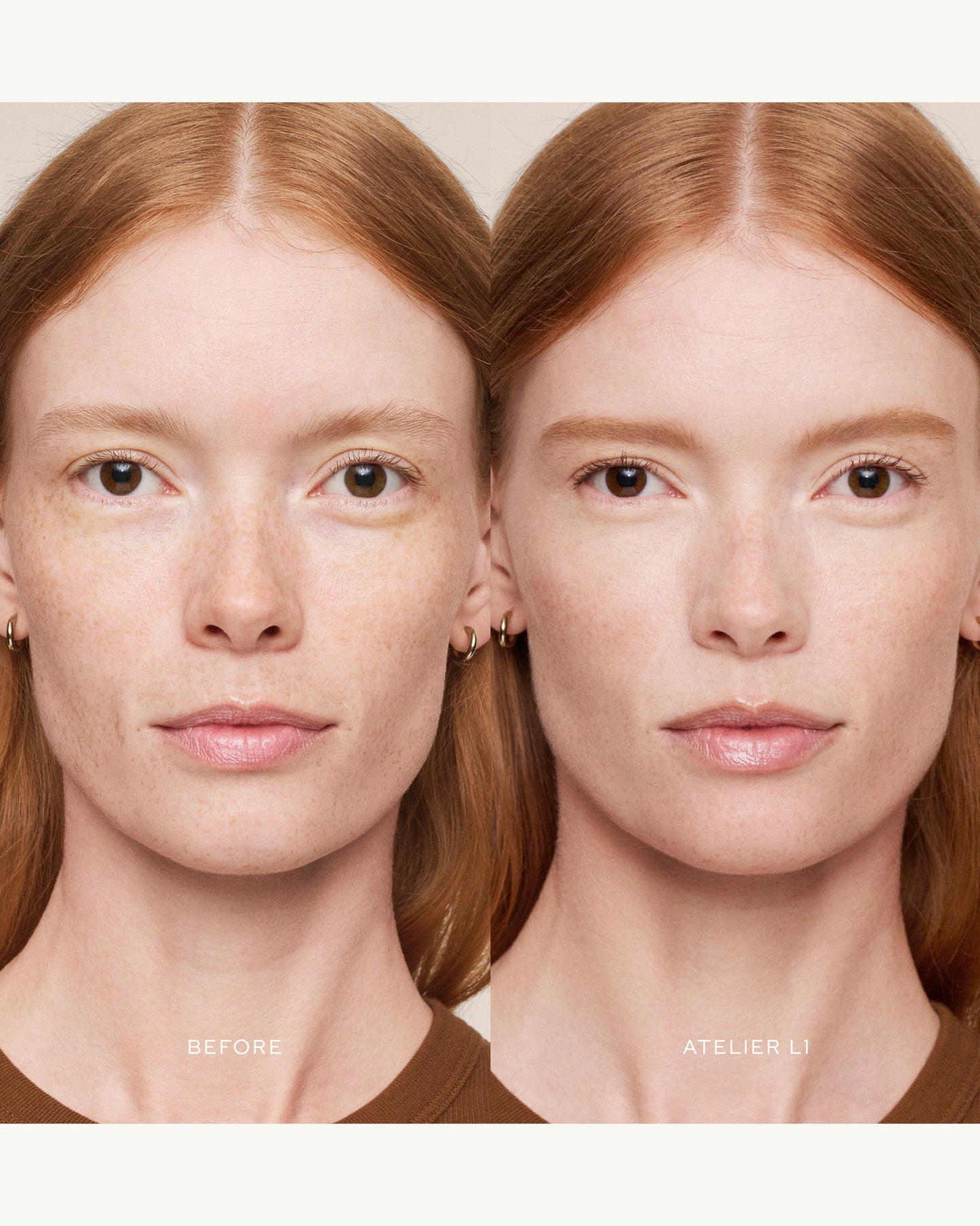 Vital Skincare Concealer