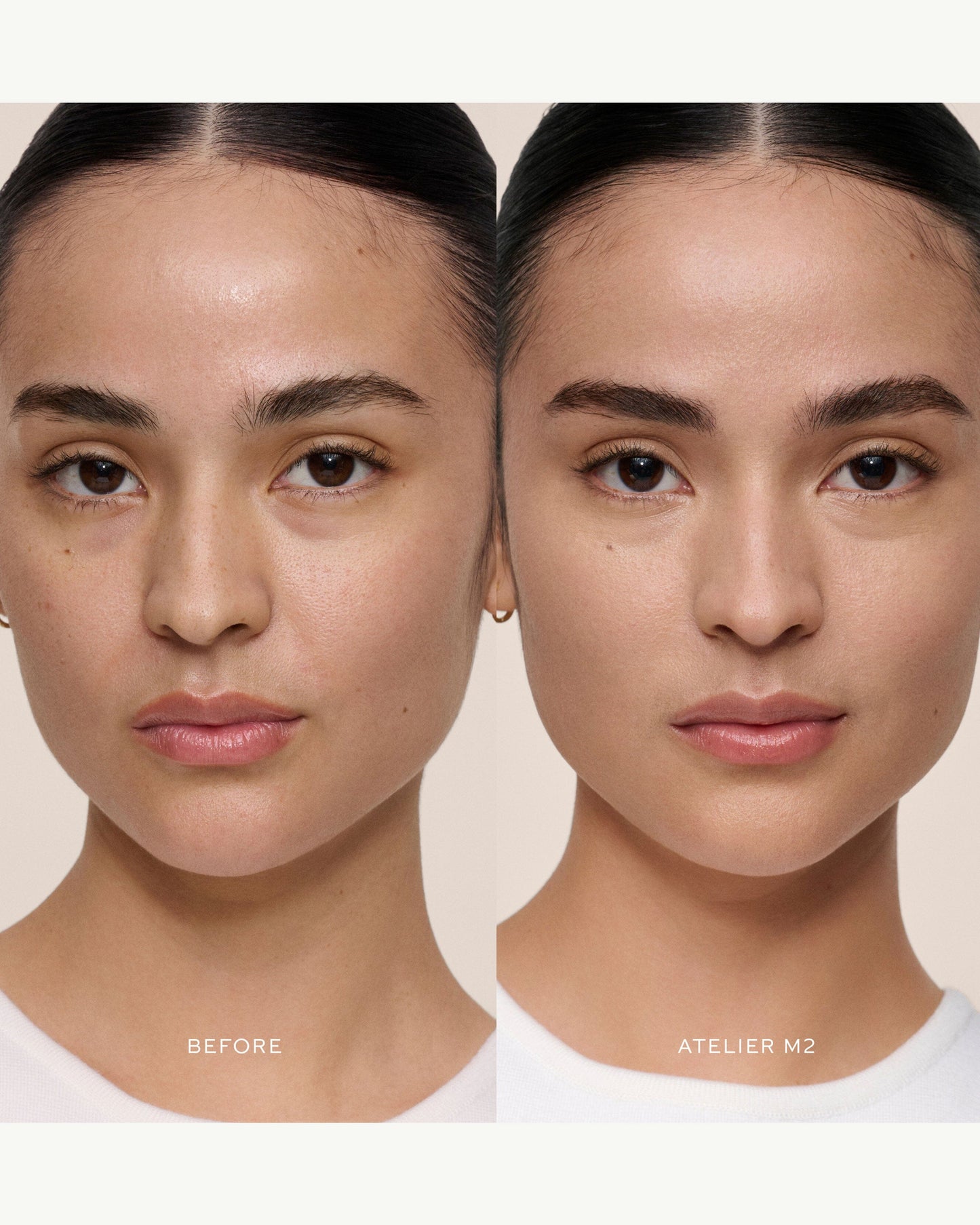 Vital Skincare Concealer