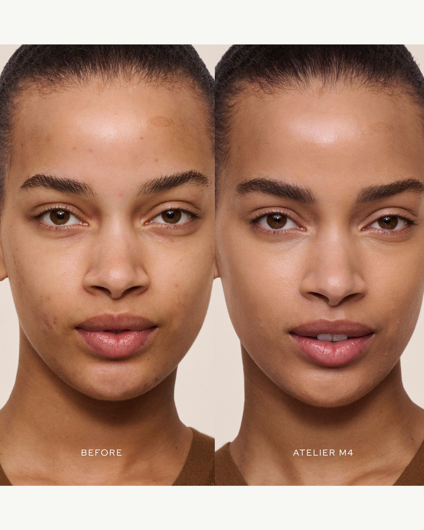 Vital Skincare Concealer