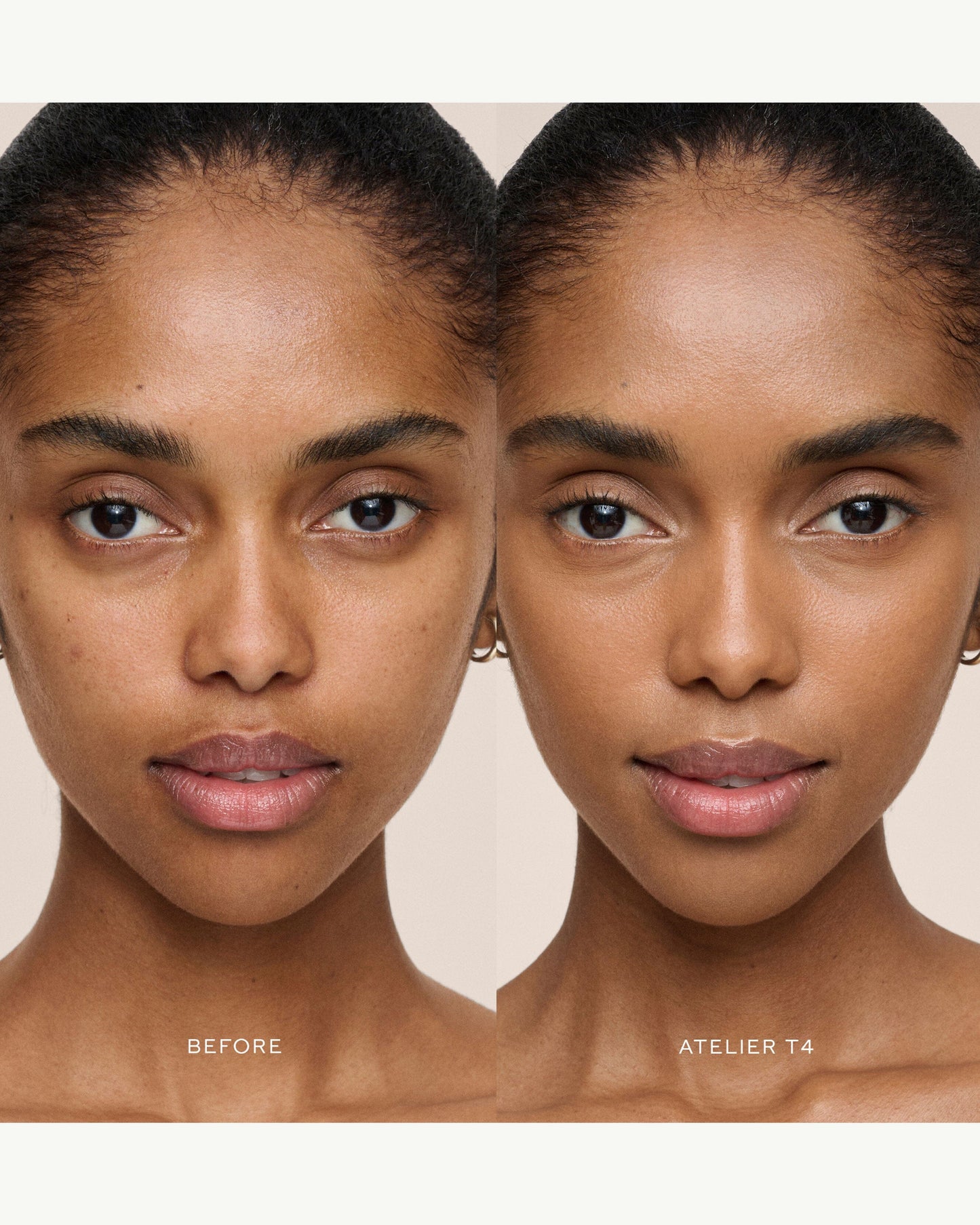 Vital Skincare Concealer
